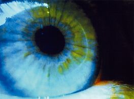 Pipilotti Rist - CLN-4711 Blue eye, 60159-15, Van Ham Kunstauktionen